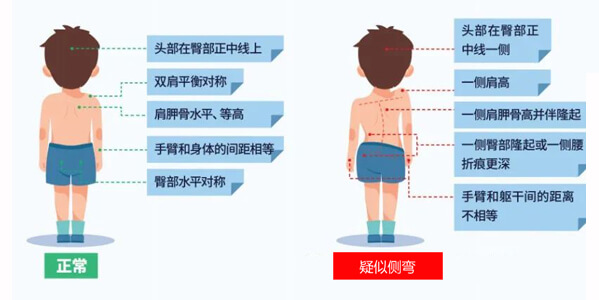 深圳市中小学生脊柱健康筛查 - 2